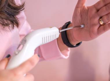 Tratamentos de Laser Acupuntura