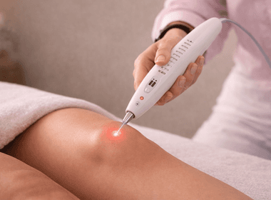 Tratamentos de Laser Acupuntura