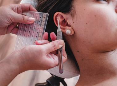 Tratamentos de AURICULOTERAPIA