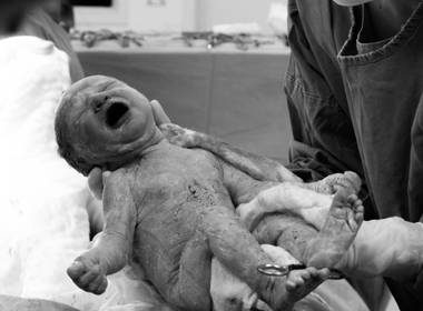 PARTOS / CESÁREAS de Nascimento Betina