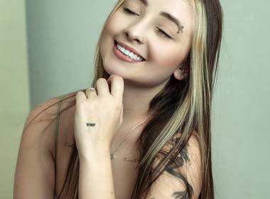 Facetas em resina composta de Amanda