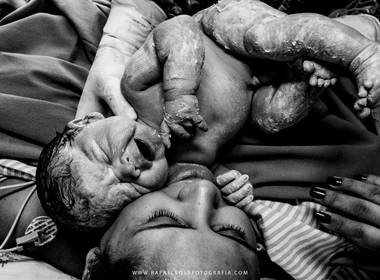 Parto de Nascimento do Murilo