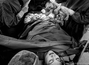 Parto de Nascimento da Ana Lis 