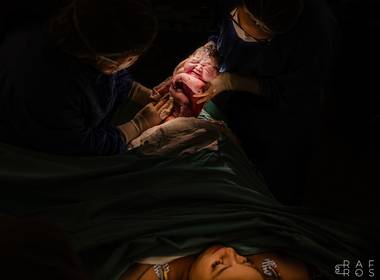 Parto de Nascimento Rafaela