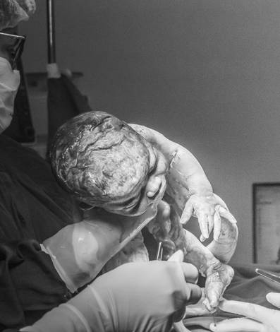 Parto de Valentim Nasceu !!!