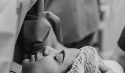 Parto de Cobertura Parto