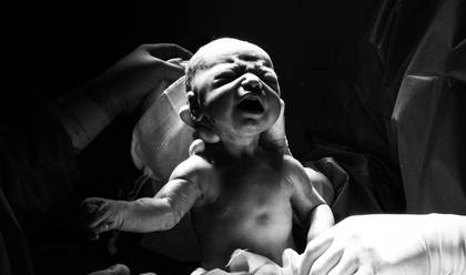 Registros de Parto - Otto