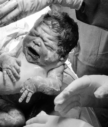 Partos de Nascimento Bia