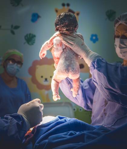 Parto de Nascimento Ana Izi