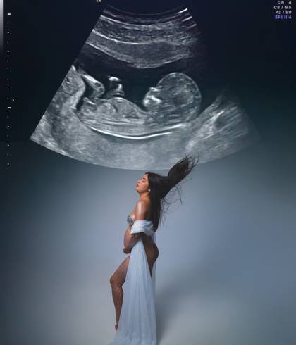 Gestantes de Gestante Brenna