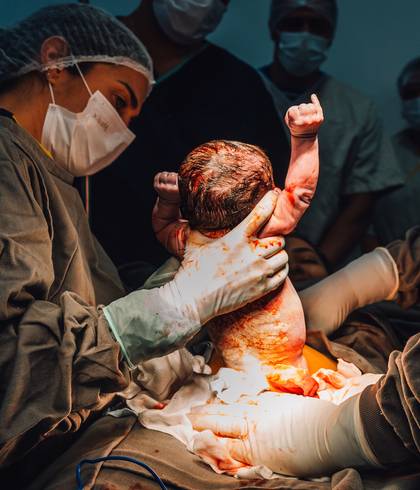 Parto de Parto da Ana Flavia