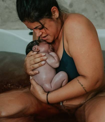 Parto de Nascimento da Bella