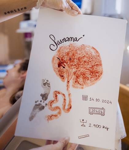 Parto de Nascimento da Savanna