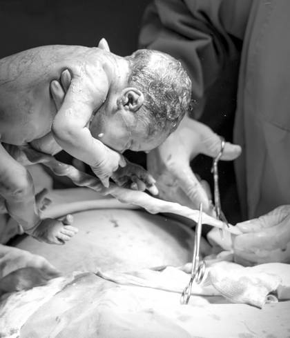 Parto de À Chegada do Joaquim - Parto