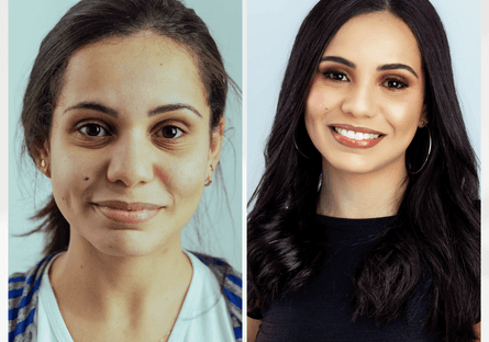 Transformação de ANTES E DEPOIS