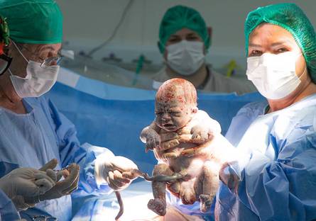 Parto de BOOK PARTO DO ARTUR - PERINATAL CAMPO GRANDE
