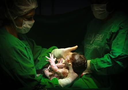 Parto de BOOK PARTO NÍCOLAS - SANTA CRUZ CEMERU 