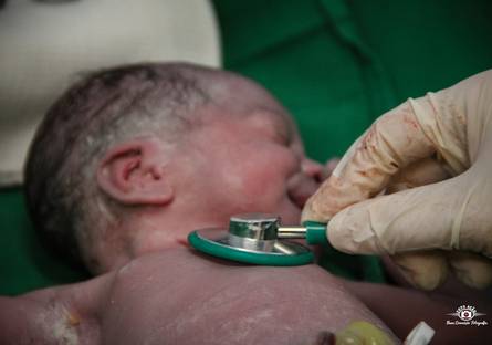 Parto de BOOK PARTO MILENA - SANTA CRUZ CEMERU