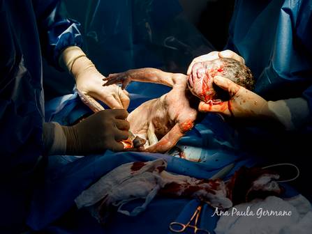 Parto de Registro de Parto - O Nascimento da Luisa