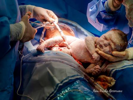 Parto de Registro de Parto - O Nascimento do Luigi