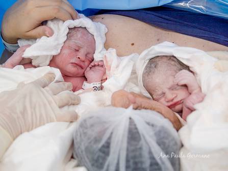Parto de Registro de Parto - O Nascimento da Manuela e da Rafaela