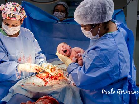 Parto de Registro de Parto - O Nascimento da Amy Lee