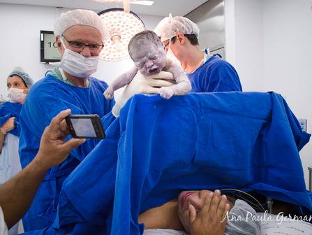 Parto de Registro de Parto - Hospital e Maternidade Santa Joana - A Chegada da Manuella