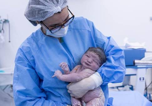 Parto de Cobertura Parto