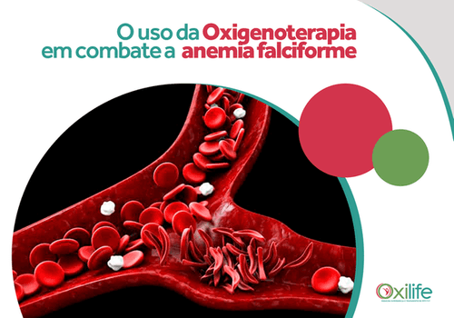 O uso da Oxigenoterapia em combate a anemia falciforme
