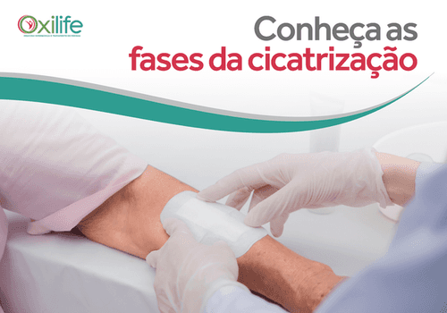Conheça as fases da cicatrização