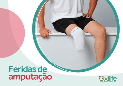 Feridas de amputação