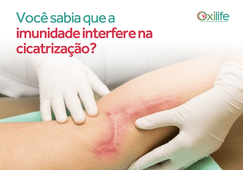 Você sabia que a sua imunidade interfere na sua cicatrização?