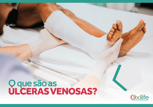 O que são úlceras venosas?
