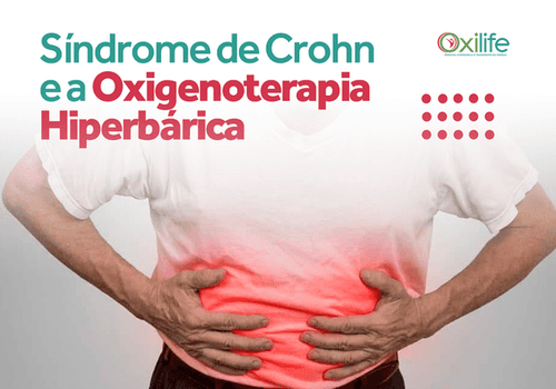 Síndrome de Crohn e a Oxigenoterapia Hiperbárica