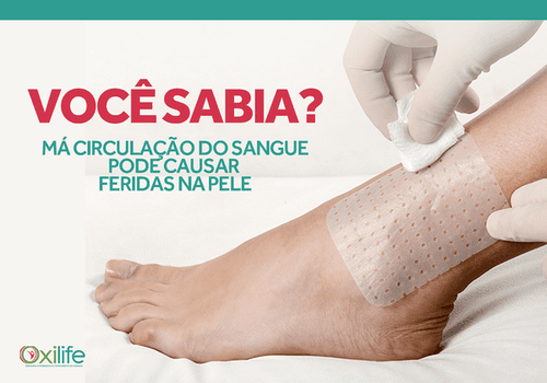 Má circulação do sangue pode causar feridas na pele