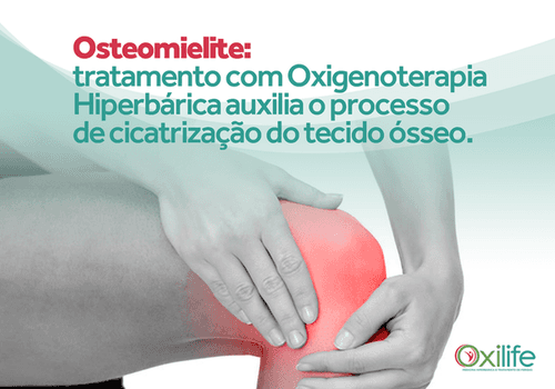 Ostemielite: Tratamento com Oxigenoterapia Hiperbárica auxilia o processo de cicatrização do tecido ósseo