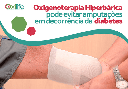 Oxigenoterapia Hiperbárica pode evitar amputações em decorrência da diabetes