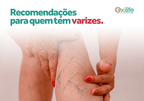 Recomendações para quem tem varizes