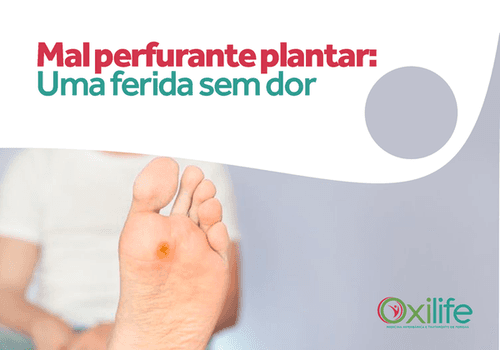 Mal perfurante plantar: Uma ferida sem dor.