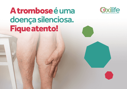 A trombose é uma doença silenciosa. Fique atento!