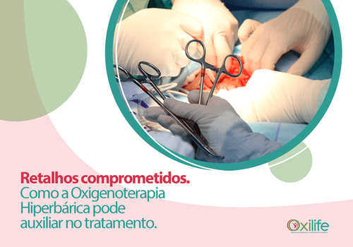 Retalhos comprometidos. Como a Oxigenoterapia Hiperbárica pode auxiliar no tratamento?