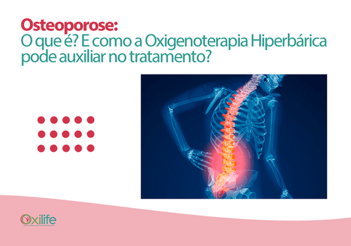 Osteoporose: O que é? E como a Oxigenoterapia Hiperbárica pode auxiliar no tratamento?