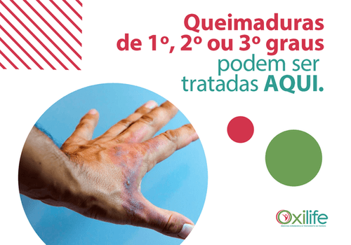 Queimaduras de 1º, 2º e 3º graus podem ser tratadas AQUI!