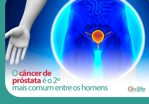 O câncer de próstata é o 2º mais comum entre os homens