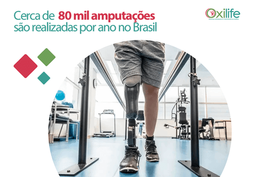 Cerca de 80 mil amputações são realizadas por ano no Brasil