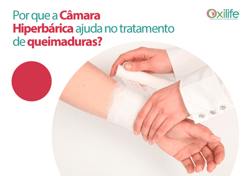 Por que a Câmara Hiperbárica ajuda no tratamento de queimaduras?