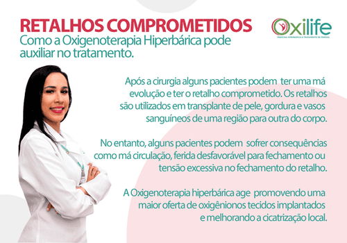 Retalhos comprometidos