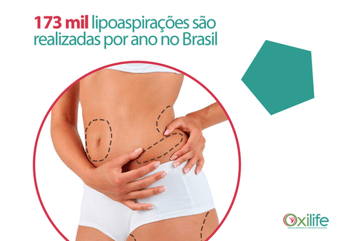 173 mil lipoaspirações são realizadas por ano no Brasil