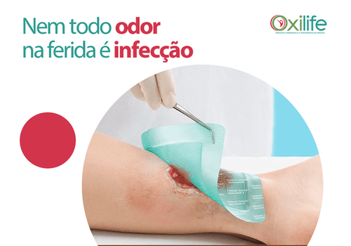 Nem todo odor na ferida é infecção