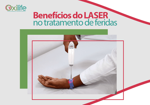Benefícios do laser no tratamento de feridas
